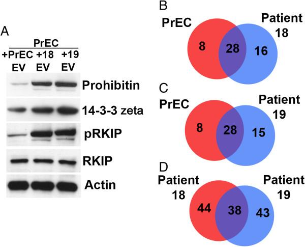 https://cdn.ncbi.nlm.nih.gov/pmc/blobs/1140/3851868/9bb38a16f9ab/1476-4598-12-118-5.jpg