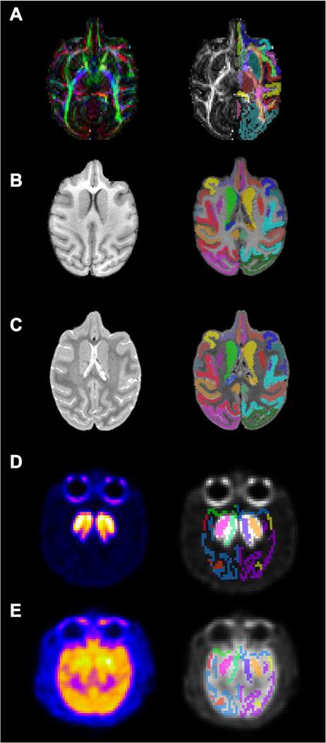 https://cdn.ncbi.nlm.nih.gov/pmc/blobs/1141/7833476/7abbedee5744/nihms-1659147-f0005.jpg
