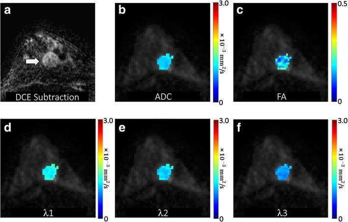 https://cdn.ncbi.nlm.nih.gov/pmc/blobs/1144/6727336/5898def16681/13058_2019_1183_Fig1_HTML.jpg