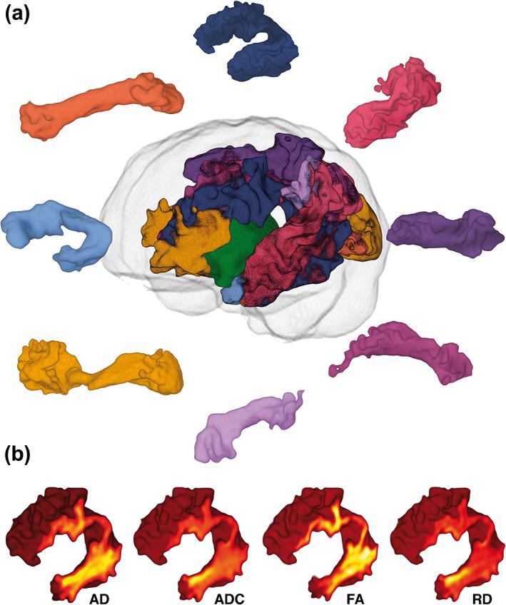 https://cdn.ncbi.nlm.nih.gov/pmc/blobs/1148/10365236/7528f4bf2f07/HBM-44-4480-g004.jpg