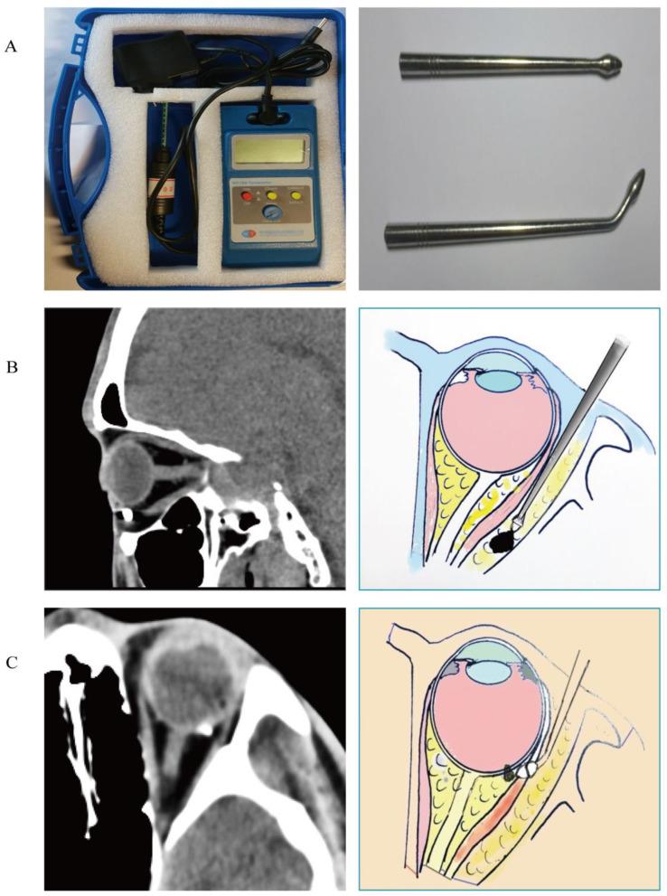 https://cdn.ncbi.nlm.nih.gov/pmc/blobs/114a/12087238/5a47fc64cca9/12886_2025_4132_Fig2_HTML.jpg