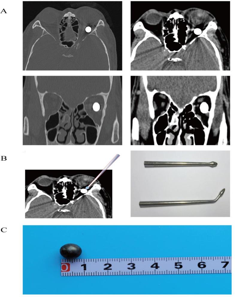 https://cdn.ncbi.nlm.nih.gov/pmc/blobs/114a/12087238/71493110f20d/12886_2025_4132_Fig3_HTML.jpg