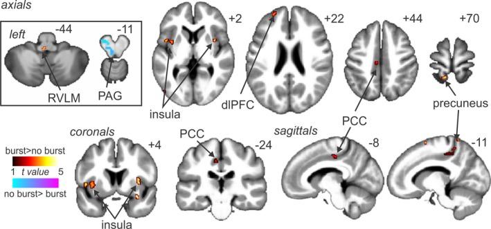 https://cdn.ncbi.nlm.nih.gov/pmc/blobs/114e/5840447/25653f92eb3e/BRB3-8-e00888-g003.jpg