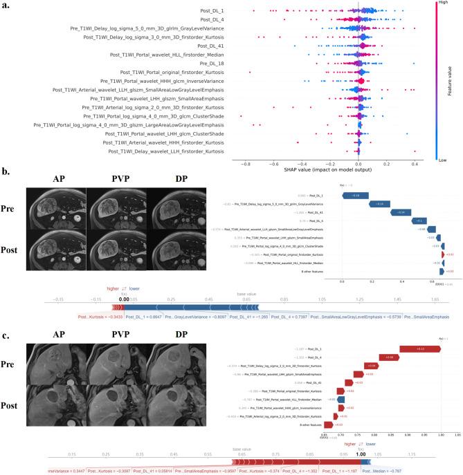 https://cdn.ncbi.nlm.nih.gov/pmc/blobs/1150/12366127/0937dc010784/40644_2025_926_Fig4_HTML.jpg