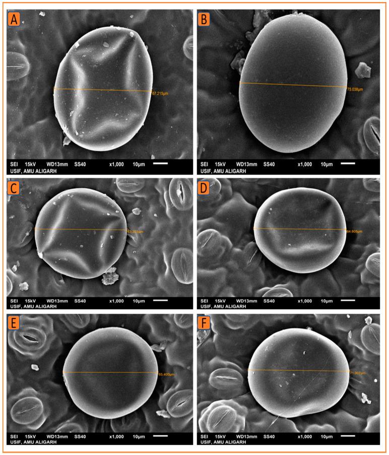 https://cdn.ncbi.nlm.nih.gov/pmc/blobs/1153/9962011/84889f09bad9/plants-12-00809-g011.jpg