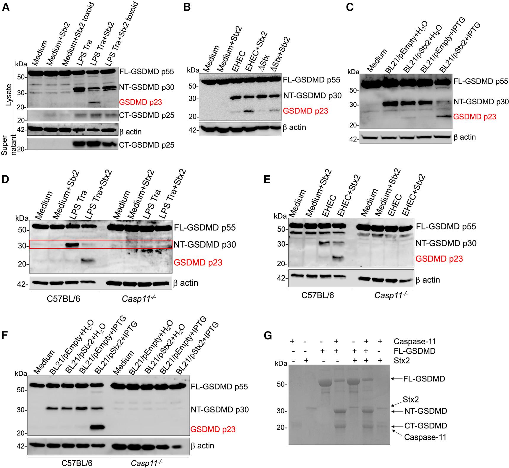 https://cdn.ncbi.nlm.nih.gov/pmc/blobs/1154/11095105/4373c2639477/nihms-1988690-f0002.jpg