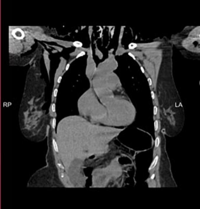 https://cdn.ncbi.nlm.nih.gov/pmc/blobs/115c/12059402/686d2ed88ff7/gr3.jpg