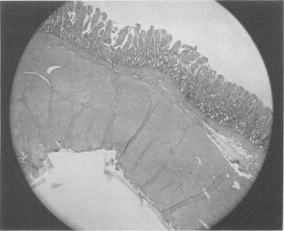 https://cdn.ncbi.nlm.nih.gov/pmc/blobs/115d/1613807/3821da504237/annsurg01286-0106-a.jpg