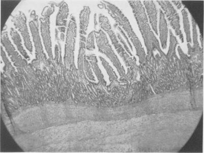 https://cdn.ncbi.nlm.nih.gov/pmc/blobs/115d/1613807/e4746aaab984/annsurg01286-0106-b.jpg