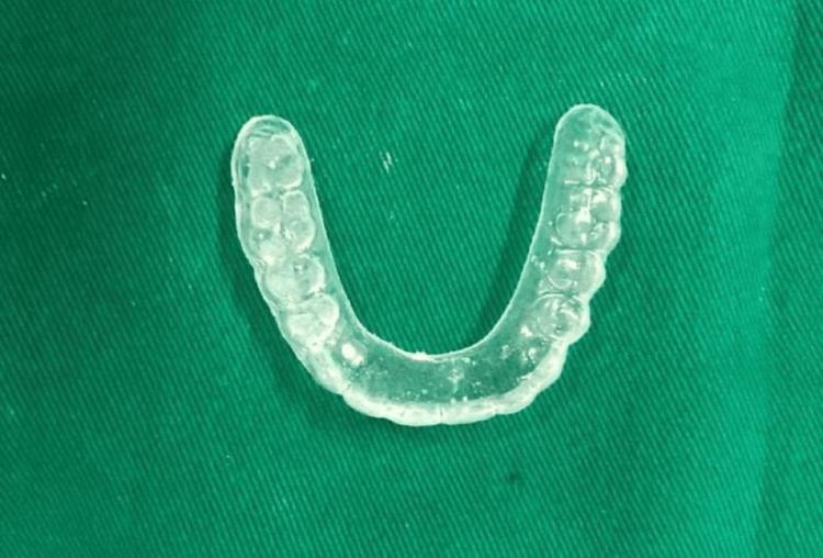https://cdn.ncbi.nlm.nih.gov/pmc/blobs/1162/11391092/ffbd036c9b36/cureus-0016-00000066732-i08.jpg