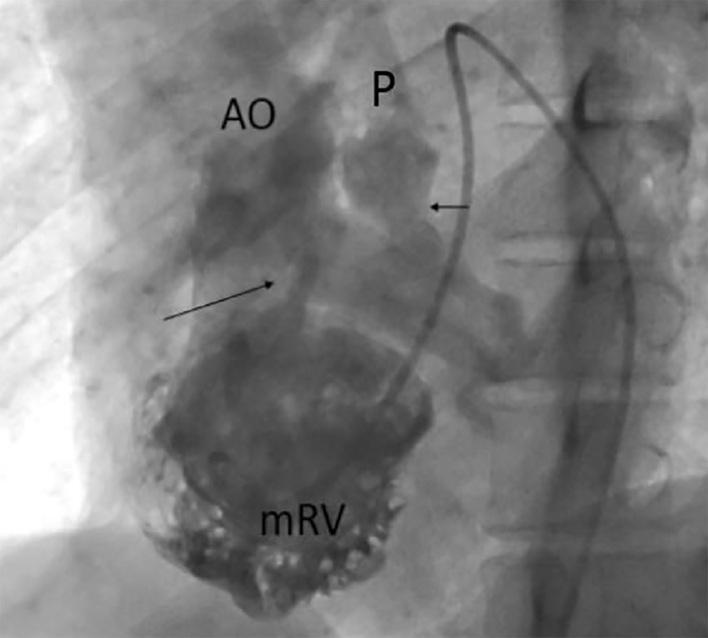 https://cdn.ncbi.nlm.nih.gov/pmc/blobs/116c/5308496/16f8149546d8/EPJ-09-3570-g002.jpg