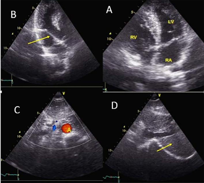 https://cdn.ncbi.nlm.nih.gov/pmc/blobs/116c/5308496/5e5f207c4774/EPJ-09-3570-g003.jpg