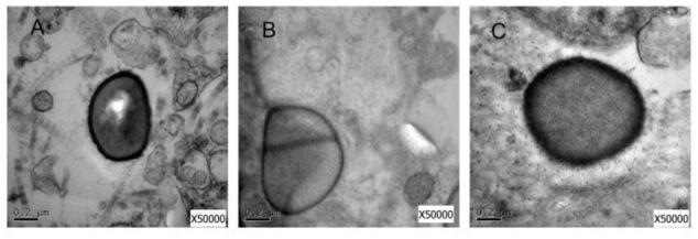https://cdn.ncbi.nlm.nih.gov/pmc/blobs/1172/5300969/a3fb74dc05b6/fmicb-08-00184-g004.jpg