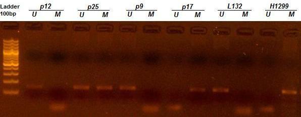 https://cdn.ncbi.nlm.nih.gov/pmc/blobs/1175/2868052/a644bc235d5e/1471-2407-10-138-1.jpg