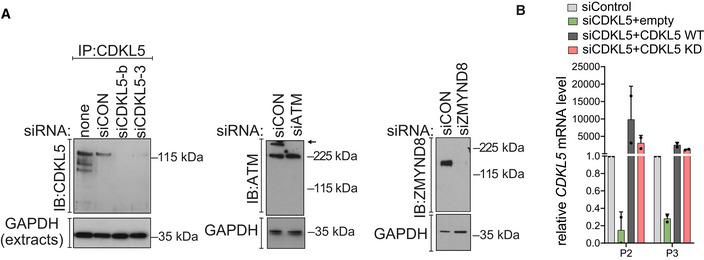 https://cdn.ncbi.nlm.nih.gov/pmc/blobs/1179/8634139/75e7b9db1d1d/EMBJ-40-e108271-g015.jpg