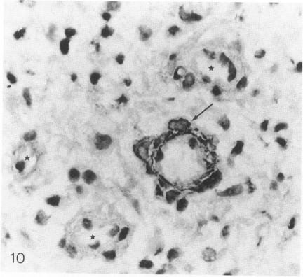 https://cdn.ncbi.nlm.nih.gov/pmc/blobs/117d/1886404/2d5ec43392ab/amjpathol00102-0053-b.jpg