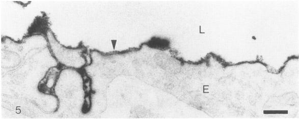 https://cdn.ncbi.nlm.nih.gov/pmc/blobs/117d/1886404/9acfb17e388d/amjpathol00102-0051-a.jpg