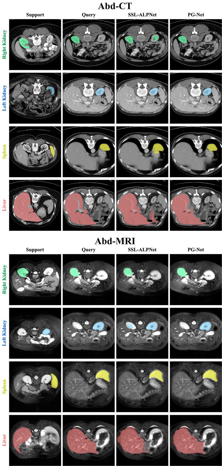 https://cdn.ncbi.nlm.nih.gov/pmc/blobs/1181/11065257/17d548fd5ee4/pone.0298227.g005.jpg