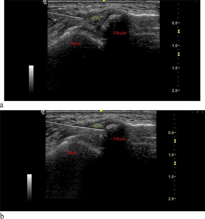 https://cdn.ncbi.nlm.nih.gov/pmc/blobs/1182/9801595/d926beb9ce80/13063_2022_7037_Fig3_HTML.jpg