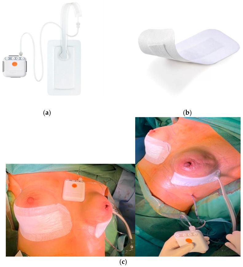 https://cdn.ncbi.nlm.nih.gov/pmc/blobs/118d/11718963/90685470ef34/cancers-17-00003-g001.jpg