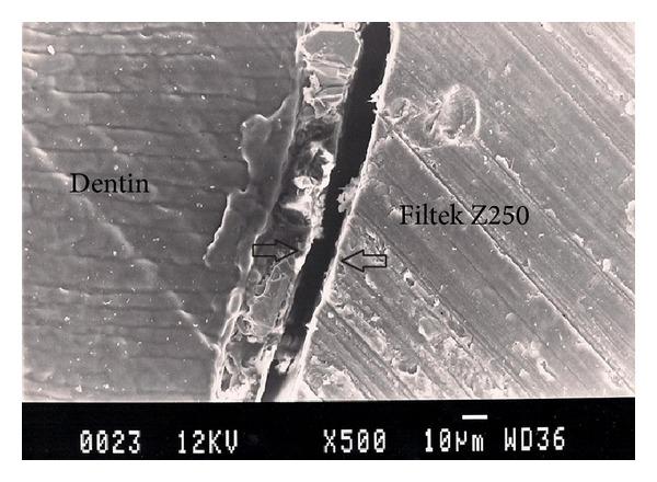 https://cdn.ncbi.nlm.nih.gov/pmc/blobs/1194/4202201/c4937702b349/IJBM2014-148057.005.jpg