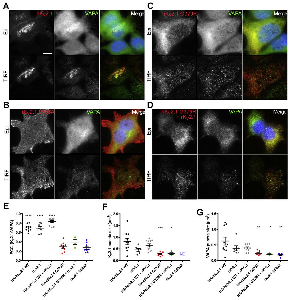 https://cdn.ncbi.nlm.nih.gov/pmc/blobs/1195/7725922/08f77d5bcad3/nihms-1644240-f0002.jpg