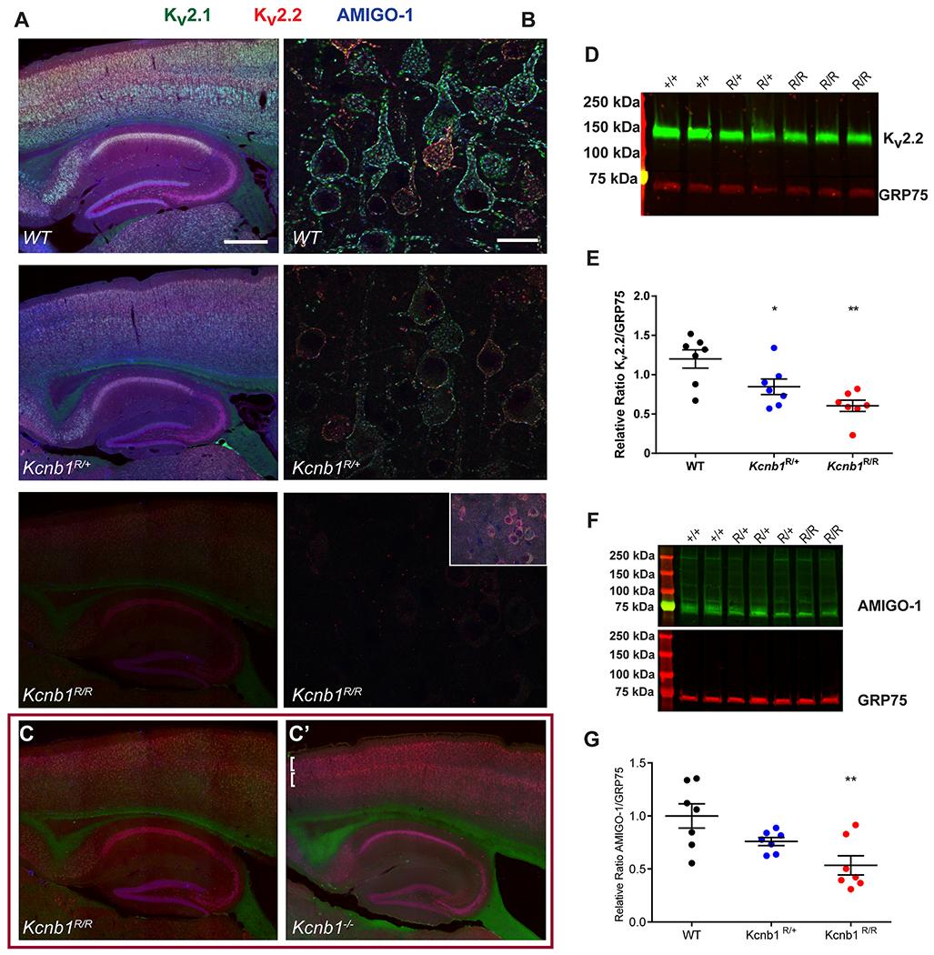 https://cdn.ncbi.nlm.nih.gov/pmc/blobs/1195/7725922/f5e092979832/nihms-1644240-f0004.jpg