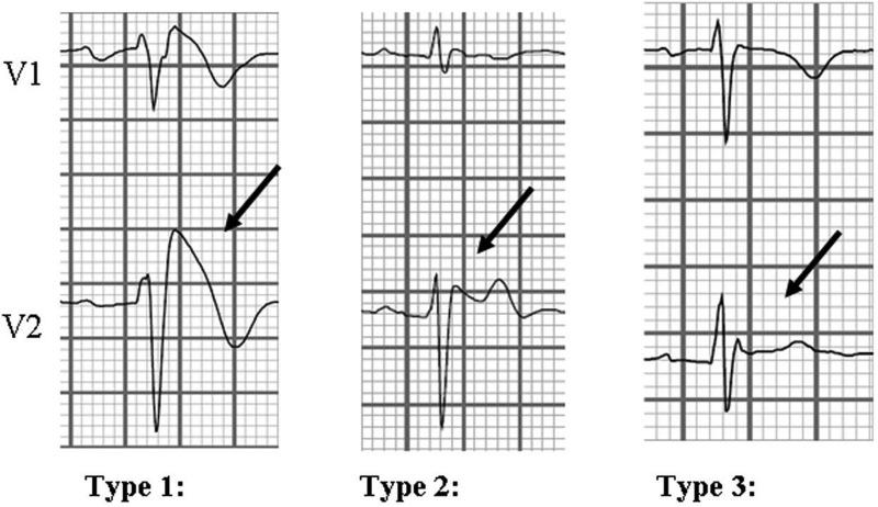 https://cdn.ncbi.nlm.nih.gov/pmc/blobs/119b/4858723/1e41d47132ff/10.1177_2054270416640153-fig3.jpg