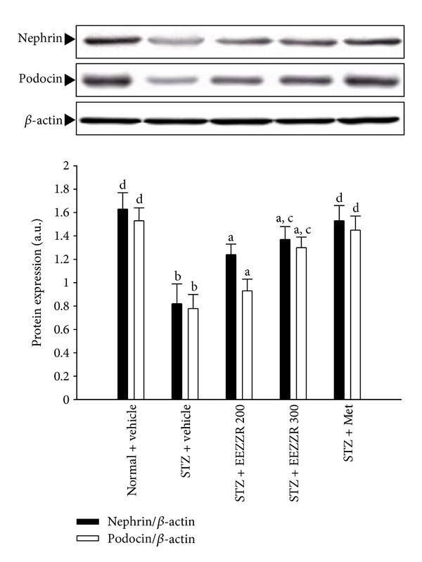 https://cdn.ncbi.nlm.nih.gov/pmc/blobs/11a2/3586471/646e0273191c/ECAM2013-340645.002.jpg