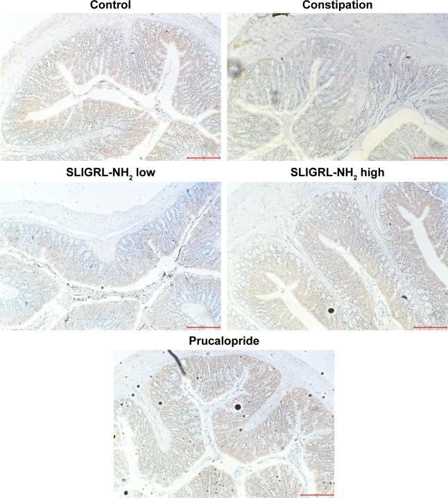 https://cdn.ncbi.nlm.nih.gov/pmc/blobs/11a2/6078190/fd8de0017b70/dddt-12-2403Fig3.jpg