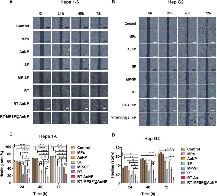 https://cdn.ncbi.nlm.nih.gov/pmc/blobs/11a5/12047280/9d273defb8c1/IJN-20-5489-g0004.jpg