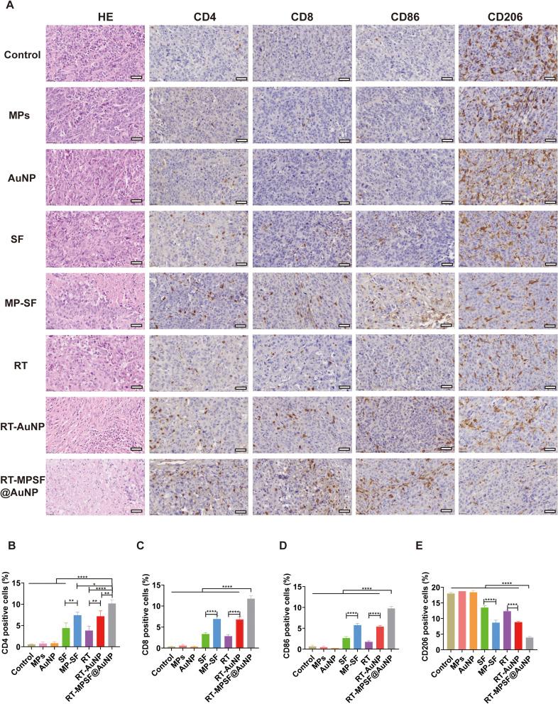 https://cdn.ncbi.nlm.nih.gov/pmc/blobs/11a5/12047280/d9c1ef490391/IJN-20-5489-g0008.jpg
