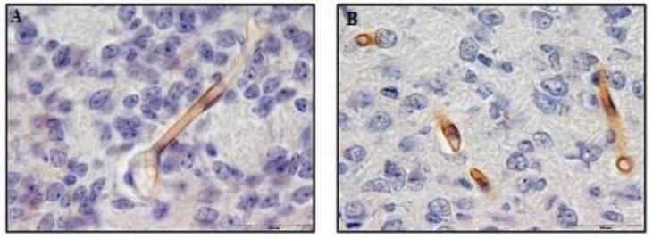https://cdn.ncbi.nlm.nih.gov/pmc/blobs/11ab/4071633/f58eb5a14fa8/ijrm-12-275-g002.jpg