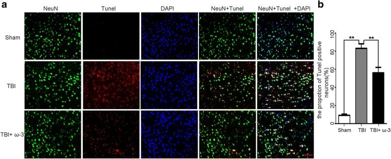 https://cdn.ncbi.nlm.nih.gov/pmc/blobs/11b0/5525354/f4e51336a0bb/12974_2017_917_Fig5_HTML.jpg