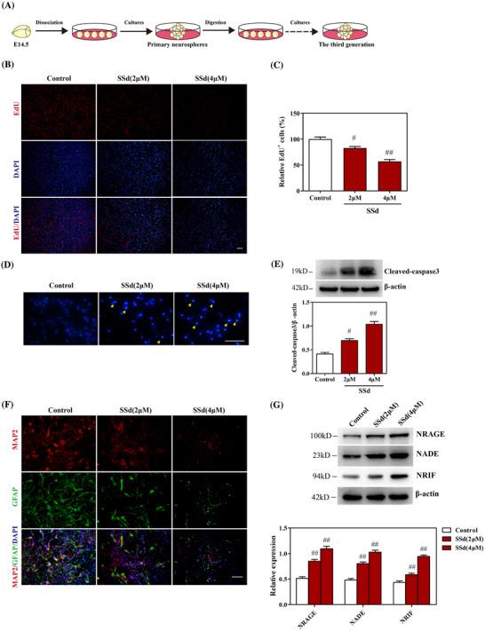 https://cdn.ncbi.nlm.nih.gov/pmc/blobs/11b0/7752162/35a8bf4b5f62/CTM2-10-e243-g003.jpg