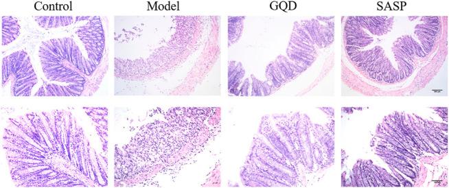 https://cdn.ncbi.nlm.nih.gov/pmc/blobs/11b6/8232523/754ac41fe1e2/fphar-12-665102-g009.jpg