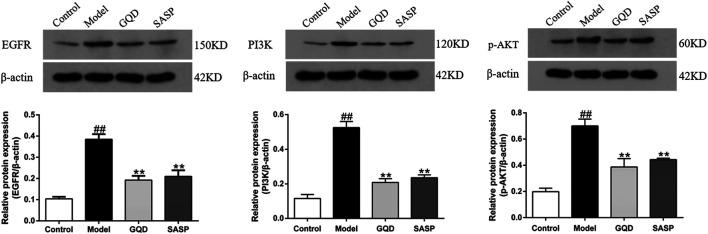 https://cdn.ncbi.nlm.nih.gov/pmc/blobs/11b6/8232523/8bc6c50ebd7b/fphar-12-665102-g011.jpg