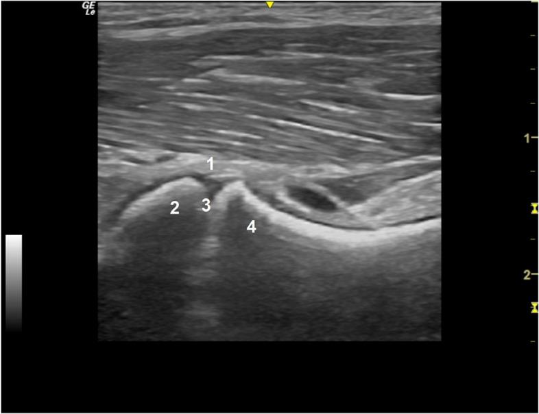 https://cdn.ncbi.nlm.nih.gov/pmc/blobs/11bb/10599070/470dda1757b3/12917_2023_3777_Fig3_HTML.jpg