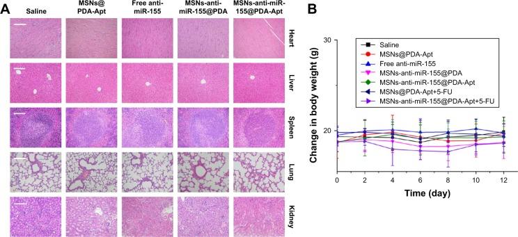 https://cdn.ncbi.nlm.nih.gov/pmc/blobs/11bb/5841950/feb8489c1c9c/ijn-13-1241Fig8.jpg