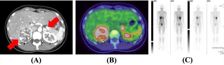 https://cdn.ncbi.nlm.nih.gov/pmc/blobs/11c5/10882191/fcfff4946603/cureus-0016-00000052760-i01.jpg