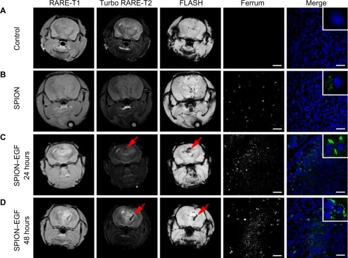 https://cdn.ncbi.nlm.nih.gov/pmc/blobs/11c5/3888267/0e3f4b179bf7/ijn-9-273Fig9.jpg