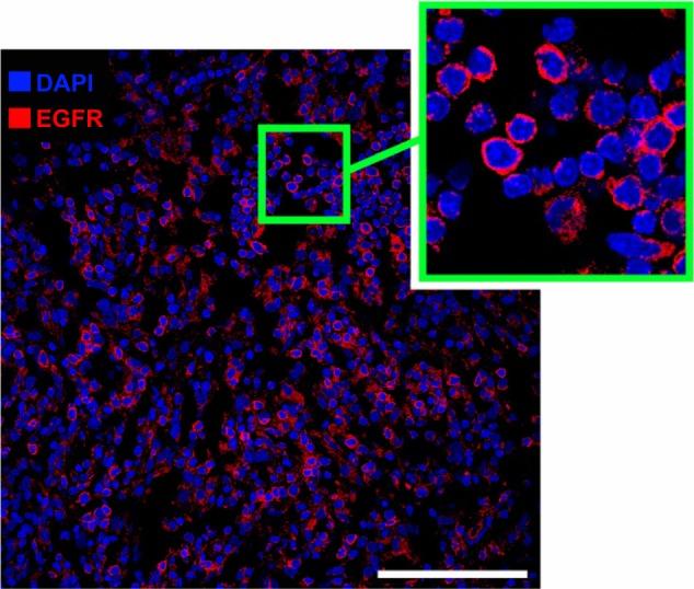 https://cdn.ncbi.nlm.nih.gov/pmc/blobs/11c5/3888267/2f0e71fbdb5b/ijn-9-273Fig8.jpg