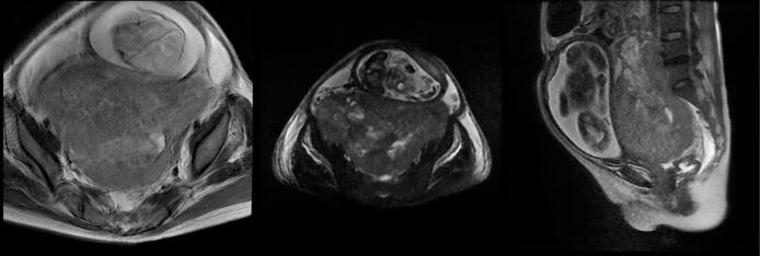 https://cdn.ncbi.nlm.nih.gov/pmc/blobs/11c9/12351171/b0458c92125d/gr1.jpg
