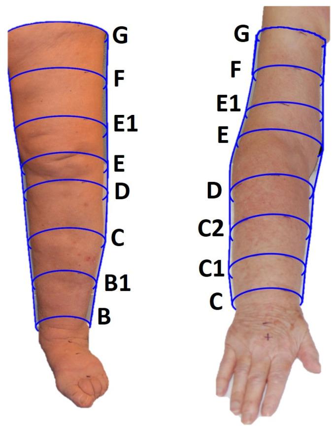 https://cdn.ncbi.nlm.nih.gov/pmc/blobs/11ca/11048605/72792c00efb8/bioengineering-11-00382-g003.jpg