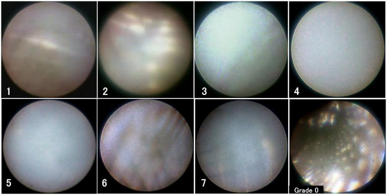 https://cdn.ncbi.nlm.nih.gov/pmc/blobs/11cf/12428471/e3d323d5e02e/fneur-16-1649290-g001.jpg