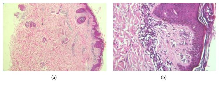 https://cdn.ncbi.nlm.nih.gov/pmc/blobs/11cf/5101376/a3f04f9c6c51/CRIM2016-6796094.002.jpg