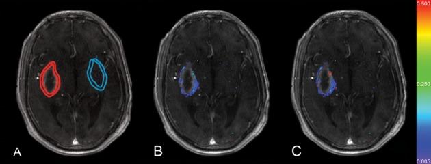https://cdn.ncbi.nlm.nih.gov/pmc/blobs/11d3/3698778/3d9964c8d6d5/jah3-2-e000161-g2.jpg