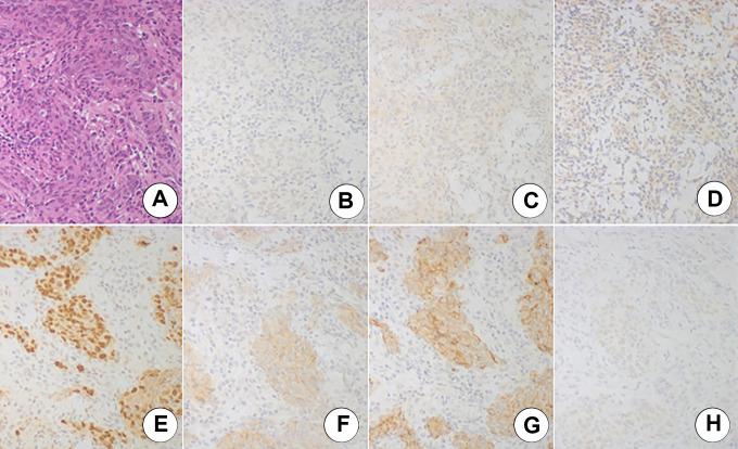 https://cdn.ncbi.nlm.nih.gov/pmc/blobs/11d3/7370551/ac0aec3cda4a/10.1177_1533033820943246-fig3.jpg
