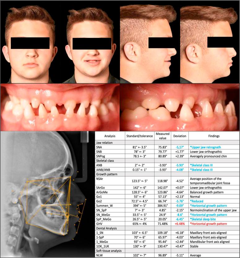 https://cdn.ncbi.nlm.nih.gov/pmc/blobs/11d7/11060206/476bcb9b5348/ms9-86-3072-g002.jpg