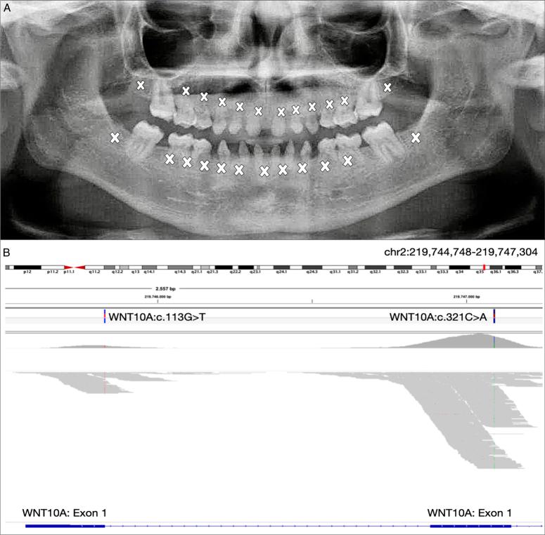 https://cdn.ncbi.nlm.nih.gov/pmc/blobs/11d7/11060206/66b805436af9/ms9-86-3072-g001.jpg